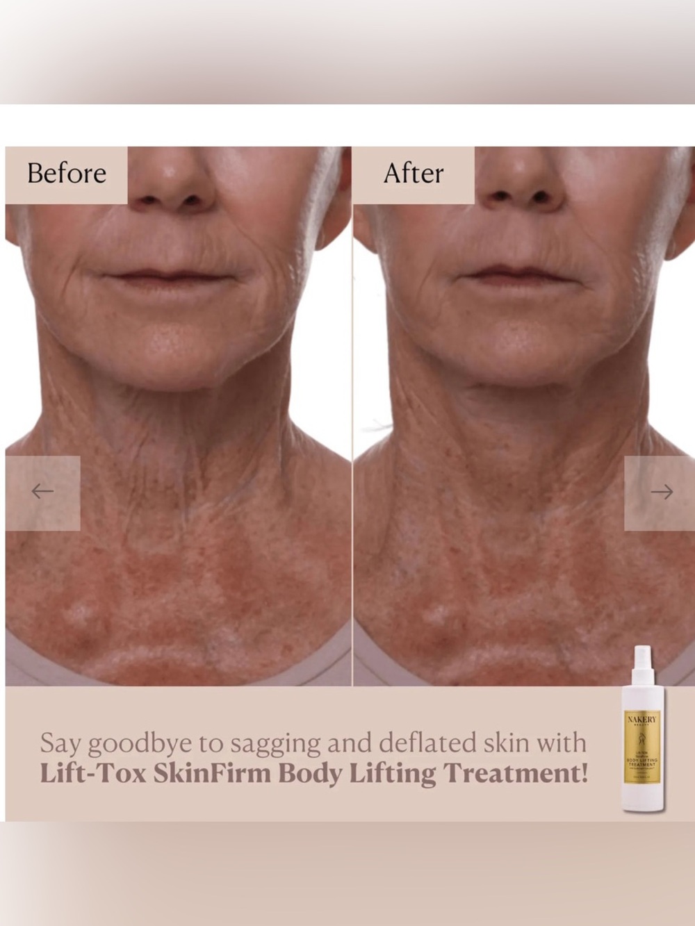 Nakery Lift-TOX SkinFirm Body Lifting Treatment - NWT - Picture 3 of 4